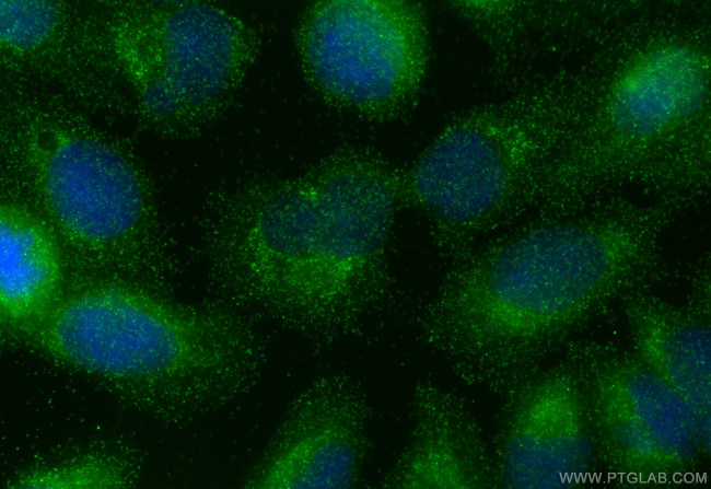 TRIM61 Antibody in Immunocytochemistry (ICC/IF)