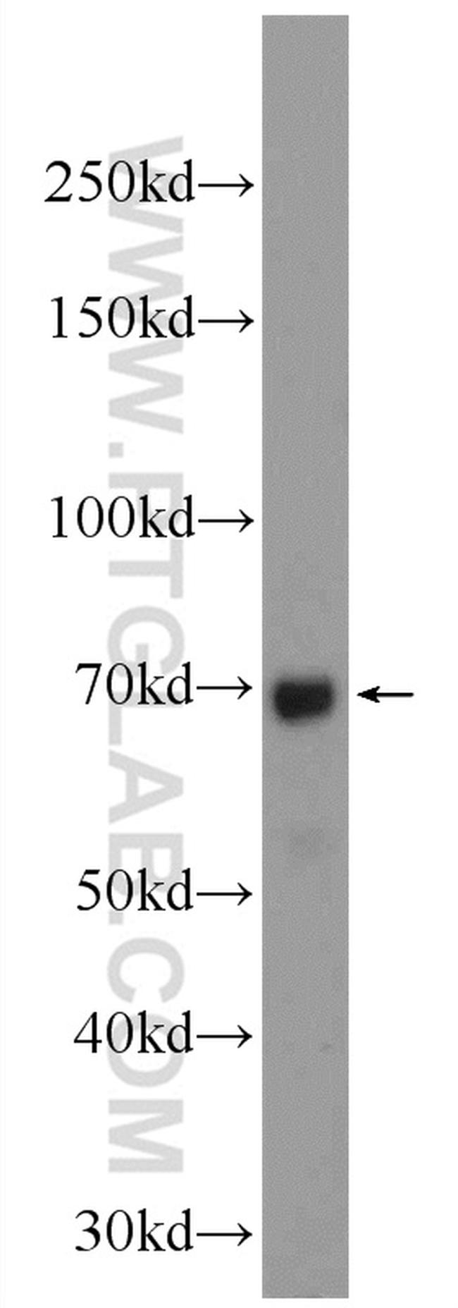 MSL1 Antibody in Western Blot (WB)