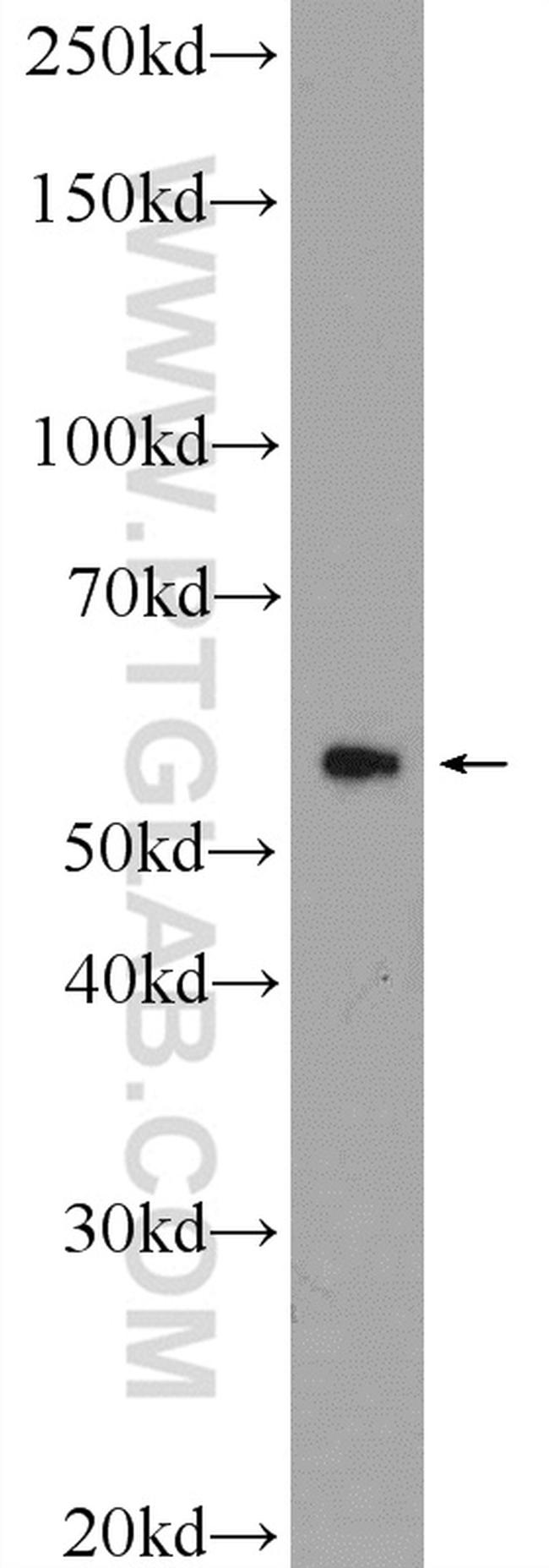 CCDC65 Antibody in Western Blot (WB)