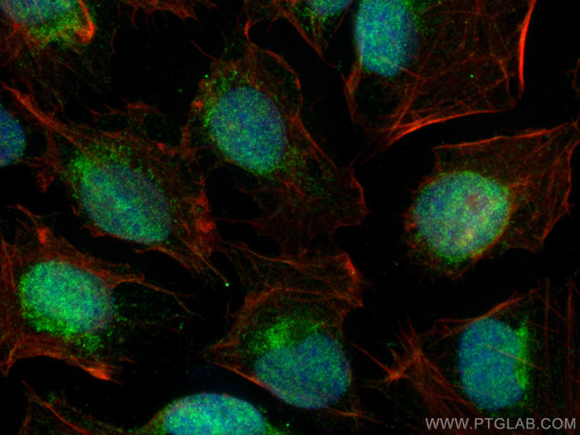 Collagen Type XXVIII Antibody in Immunocytochemistry (ICC/IF)