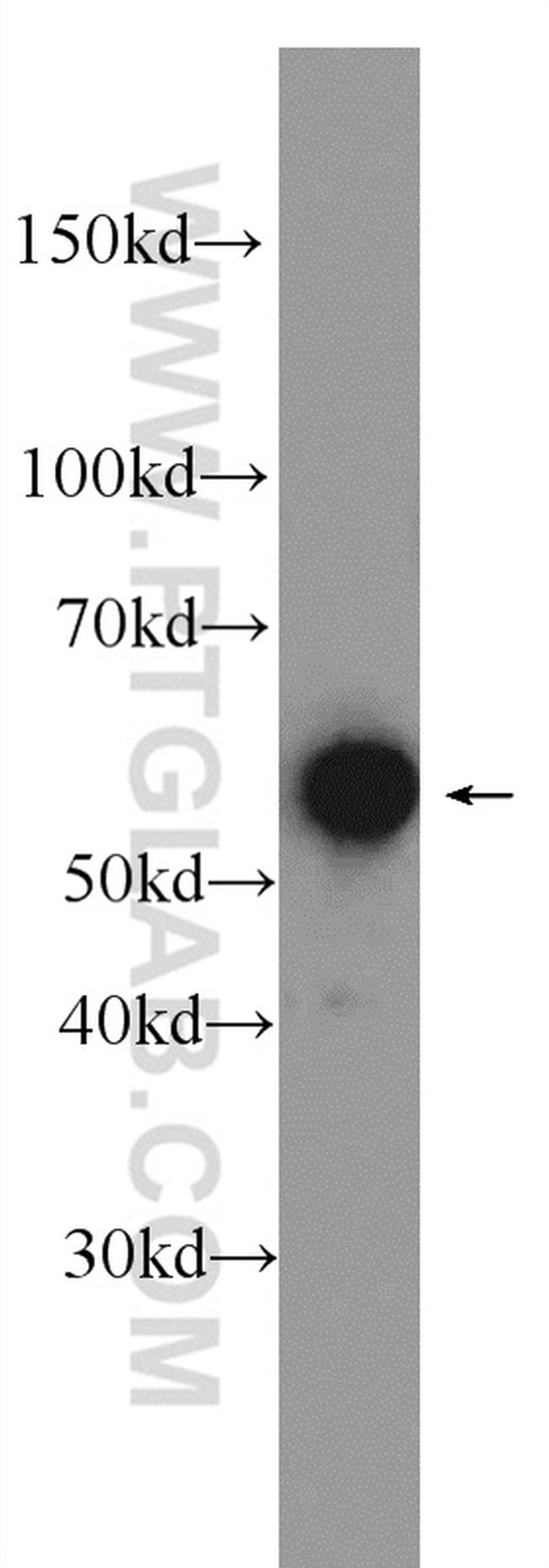 GTF2E1 Antibody in Western Blot (WB)