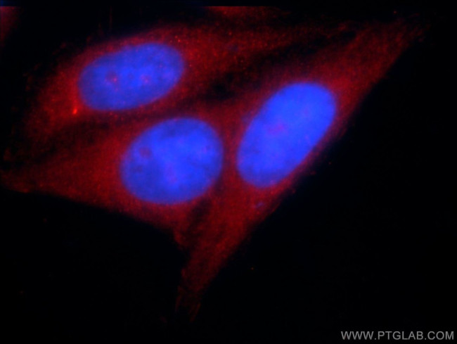 KTELC1 Antibody in Immunocytochemistry (ICC/IF)
