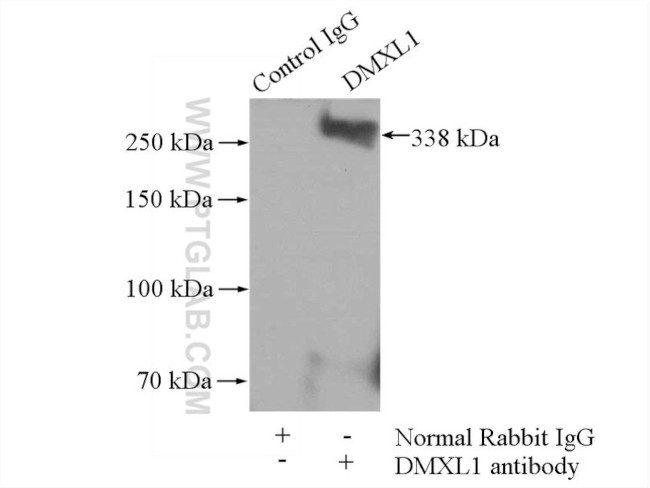 DMXL1 Antibody in Immunoprecipitation (IP)