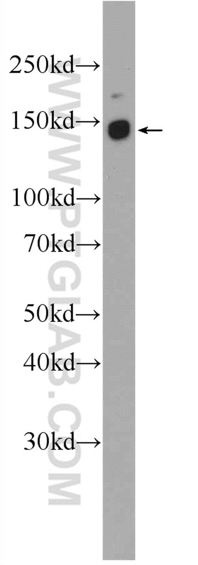 DENND3 Antibody in Western Blot (WB)