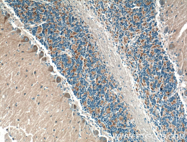DMXL2 Antibody in Immunohistochemistry (Paraffin) (IHC (P))
