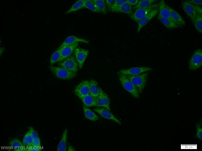 CWC25 Antibody in Immunocytochemistry (ICC/IF)