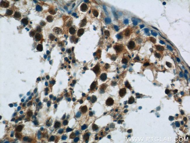 FAM48A Antibody in Immunohistochemistry (Paraffin) (IHC (P))