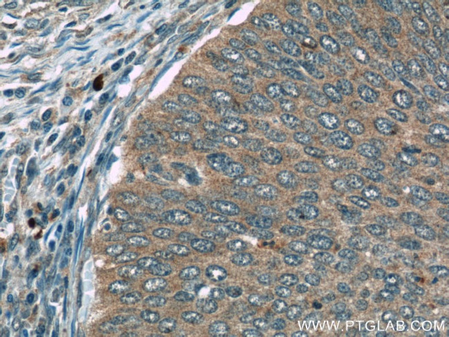 FAM168B Antibody in Immunohistochemistry (Paraffin) (IHC (P))