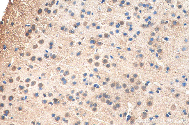 C10orf27 Antibody in Immunohistochemistry (Paraffin) (IHC (P))