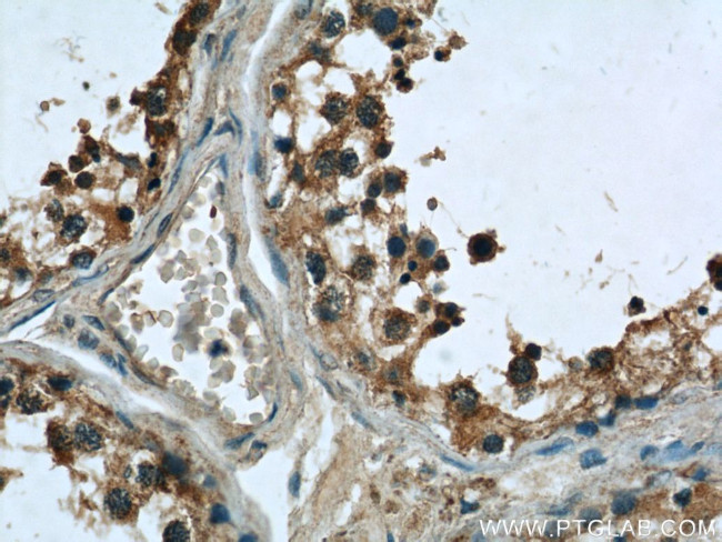 TEX38 Antibody in Immunohistochemistry (Paraffin) (IHC (P))