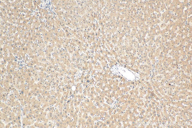 WDR7 Antibody in Immunohistochemistry (Paraffin) (IHC (P))