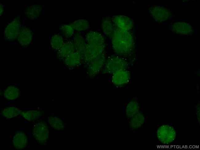 BRIP1 Antibody in Immunocytochemistry (ICC/IF)