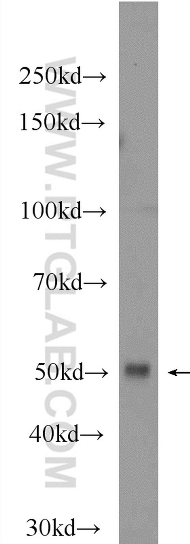 IRF8 Antibody in Western Blot (WB)