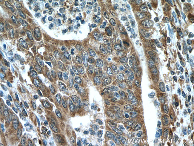 IRX6 Antibody in Immunohistochemistry (Paraffin) (IHC (P))