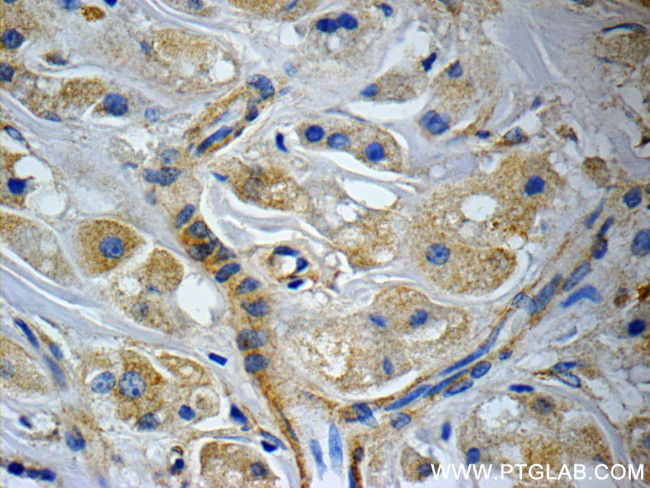 CCDC53 Antibody in Immunohistochemistry (Paraffin) (IHC (P))