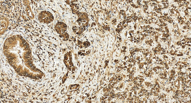 RCCD1 Antibody in Immunohistochemistry (Paraffin) (IHC (P))