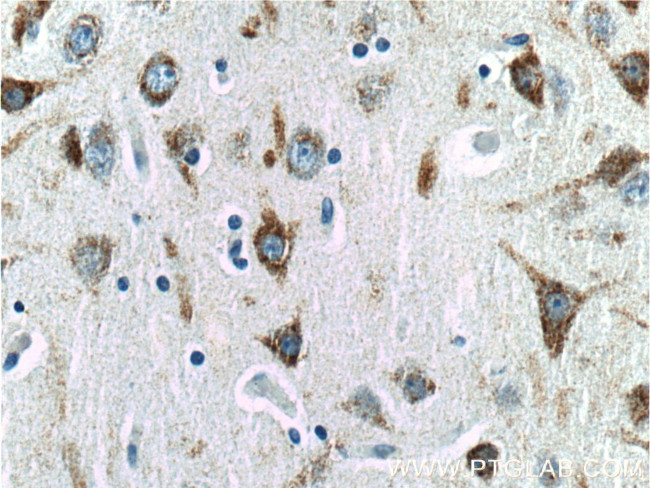 EPHA6 Antibody in Immunohistochemistry (Paraffin) (IHC (P))