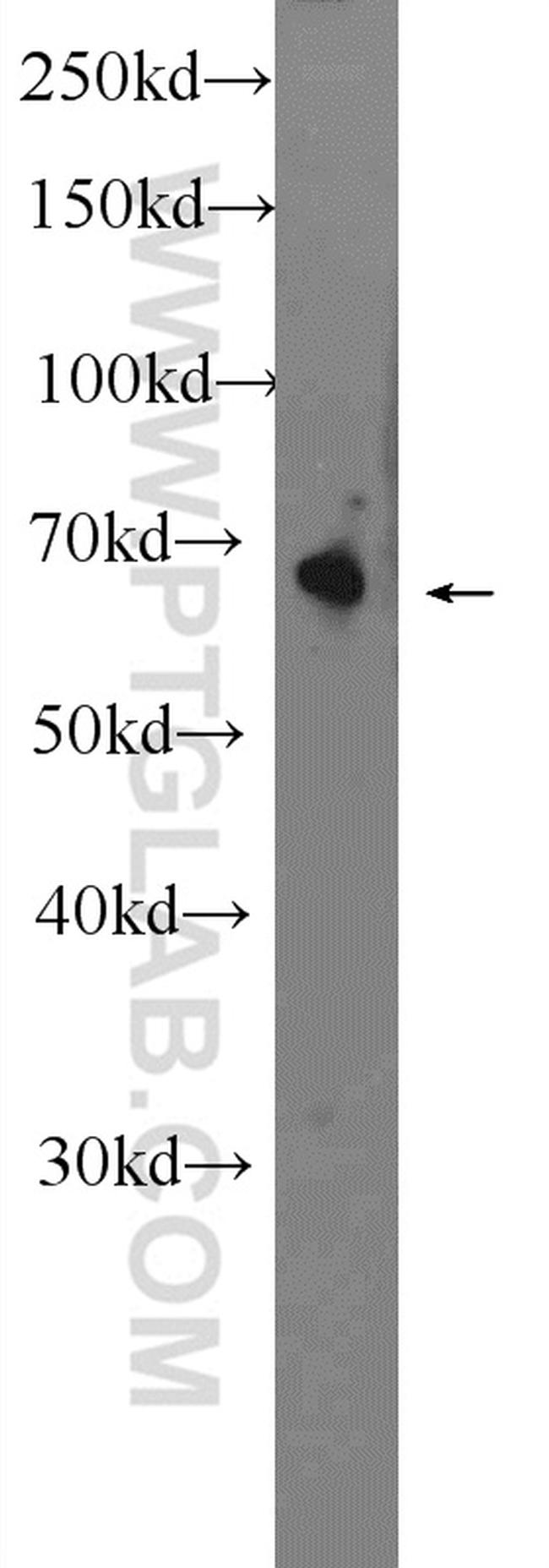 OTOP1 Antibody in Western Blot (WB)