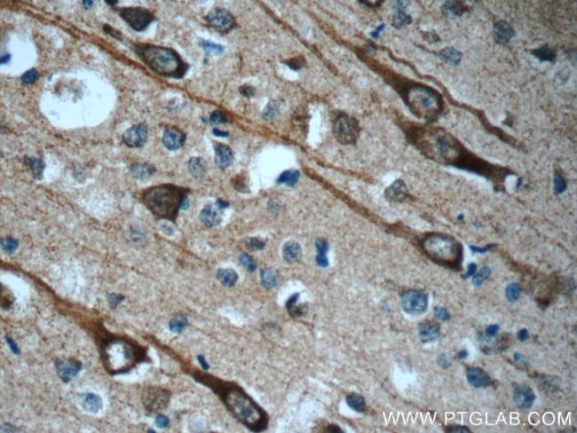 CEP44 Antibody in Immunohistochemistry (Paraffin) (IHC (P))