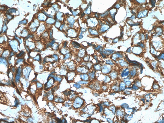 GEF-H1 Antibody in Immunohistochemistry (Paraffin) (IHC (P))