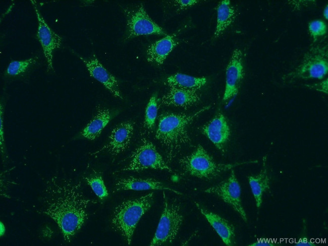 C1QBP Antibody in Immunocytochemistry (ICC/IF)