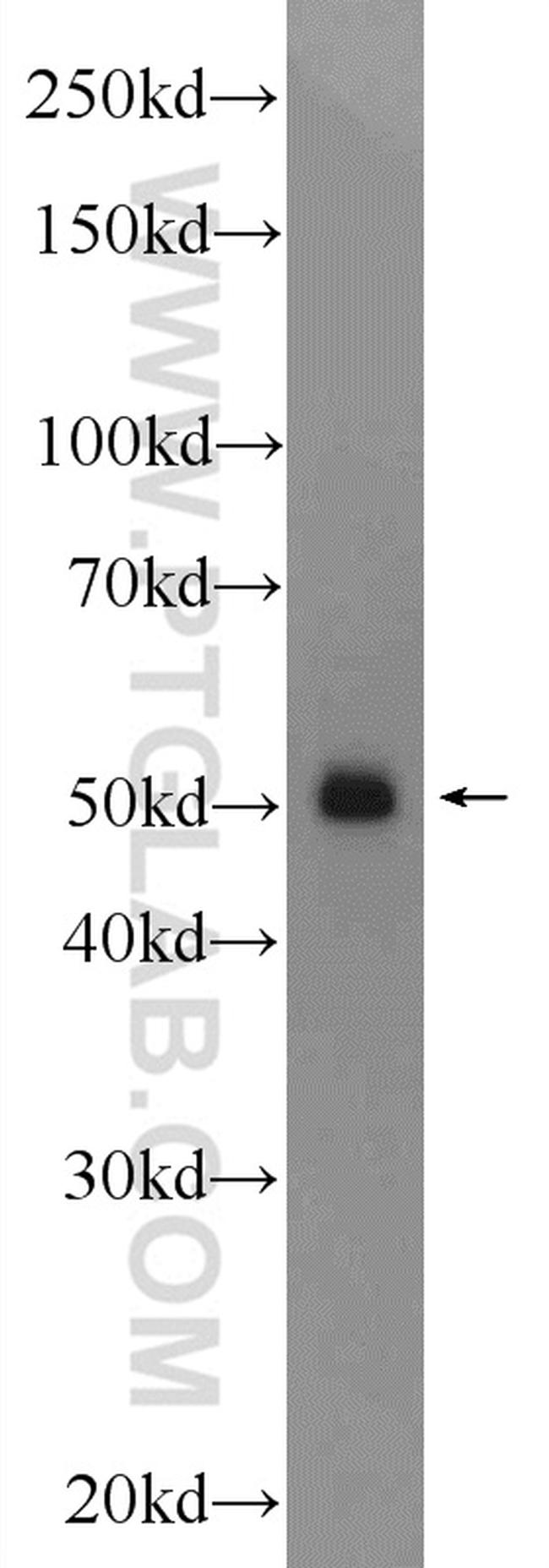 TMEM194A Antibody in Western Blot (WB)