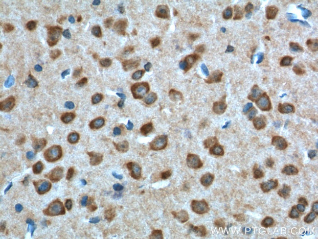 GPR19 Antibody in Immunohistochemistry (Paraffin) (IHC (P))