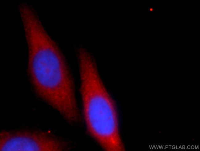 AMZ1 Antibody in Immunocytochemistry (ICC/IF)