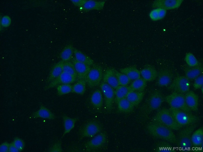 OTUD6A Antibody in Immunocytochemistry (ICC/IF)