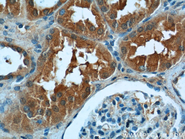 DNAH17 Antibody in Immunohistochemistry (Paraffin) (IHC (P))
