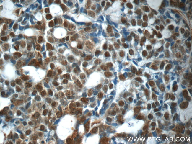 E2F7 Antibody in Immunohistochemistry (Paraffin) (IHC (P))