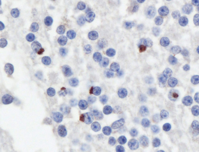 GP repeat Antibody in Immunohistochemistry (IHC)