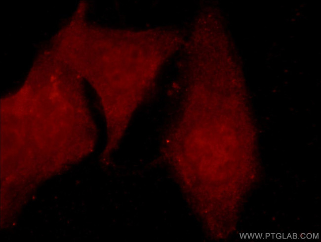 ARID4B Antibody in Immunocytochemistry (ICC/IF)