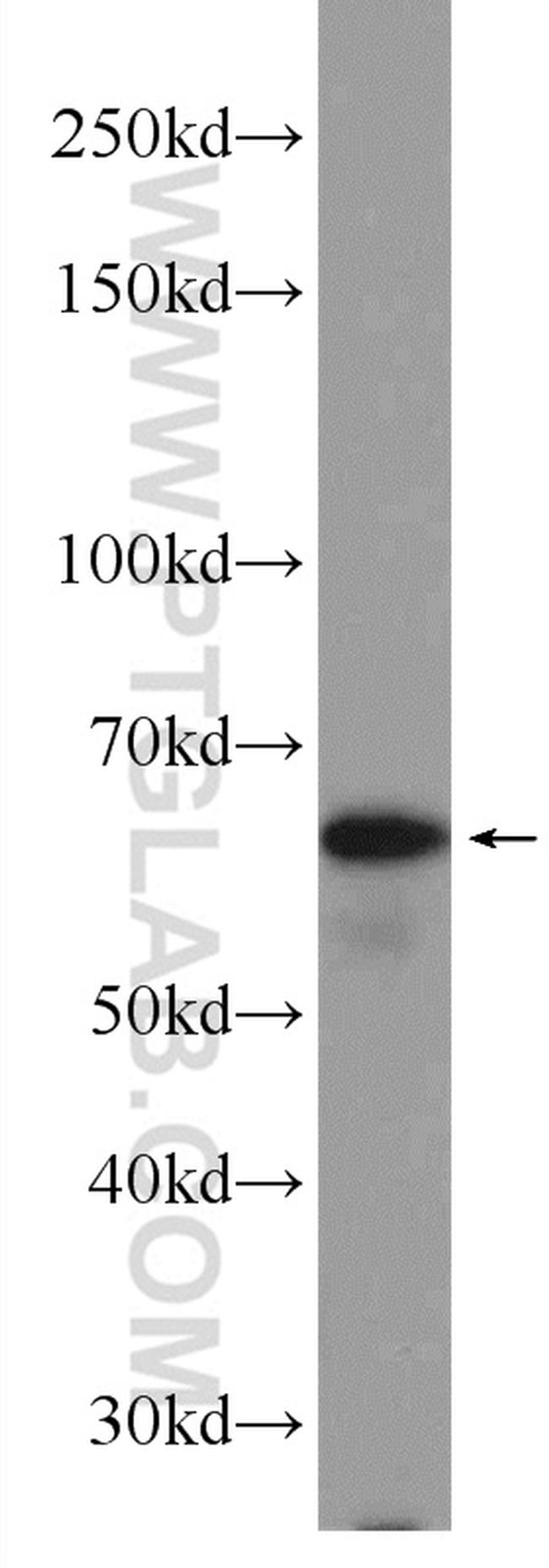 PPP2R3B Antibody in Western Blot (WB)