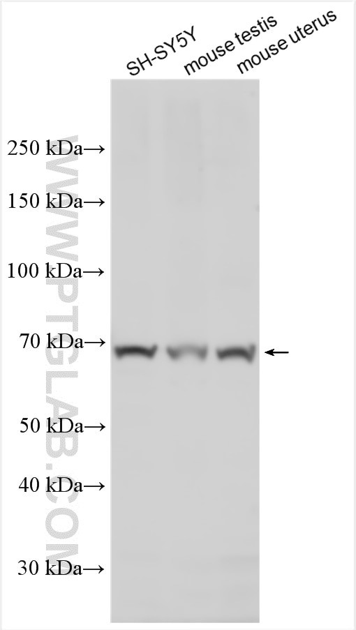 DCBLD1 Antibody in Western Blot (WB)
