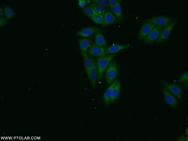 VPS13B Antibody in Immunocytochemistry (ICC/IF)
