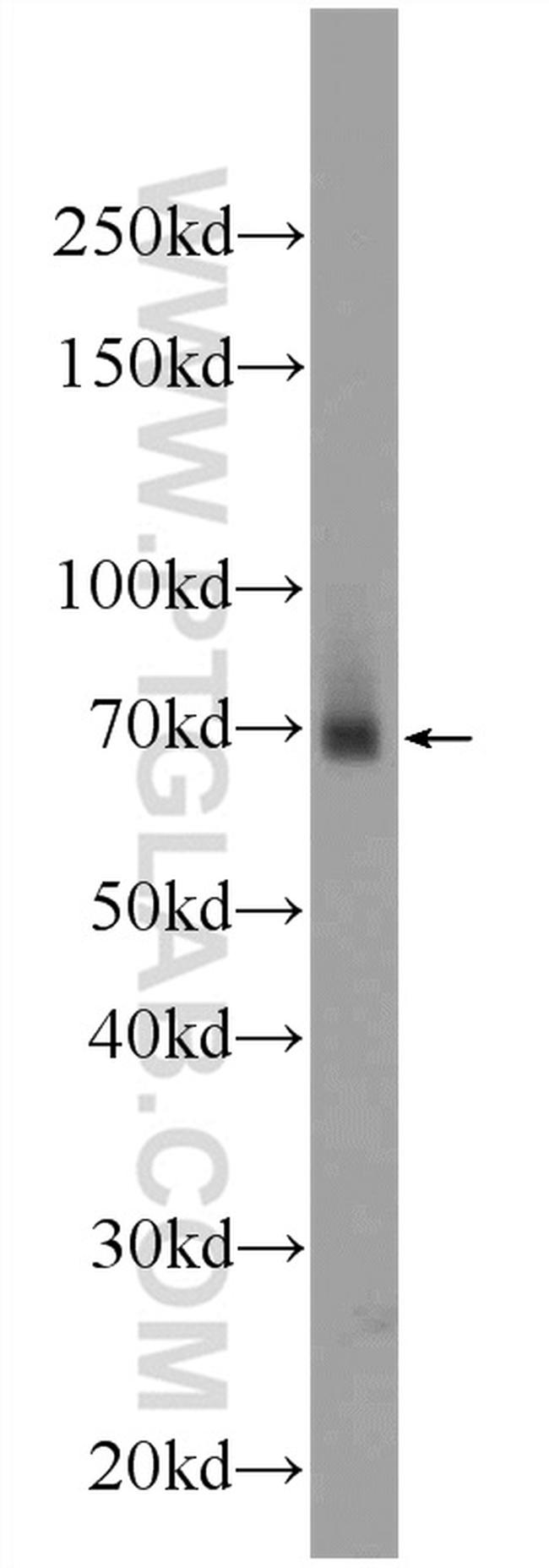 ZNF512 Antibody in Western Blot (WB)