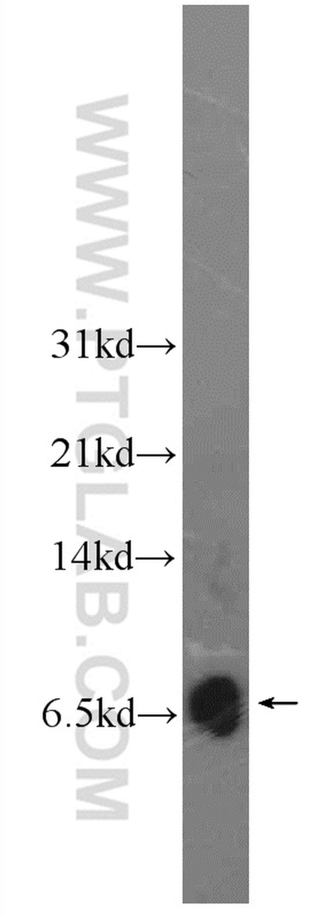 C6orf173 Antibody in Western Blot (WB)