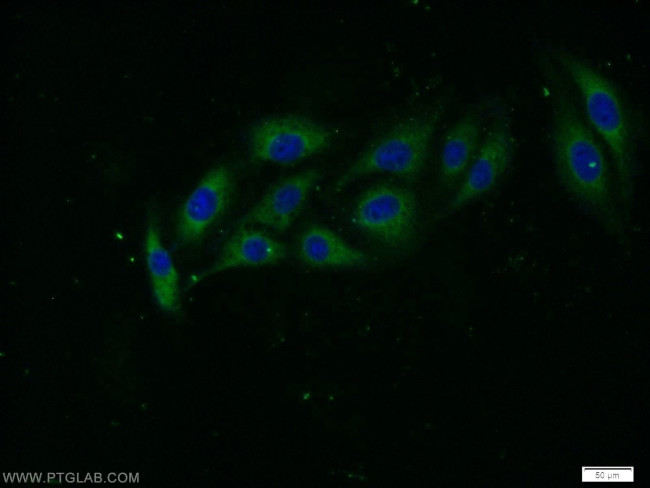 STXBP5 Antibody in Immunocytochemistry (ICC/IF)