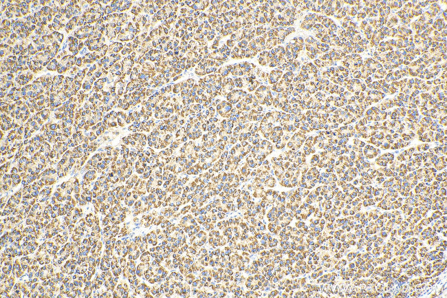 CPS1 Antibody in Immunohistochemistry (Paraffin) (IHC (P))