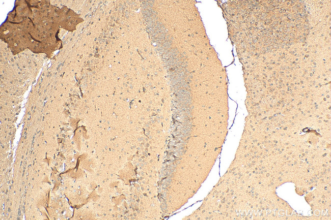 FBXO41 Antibody in Immunohistochemistry (Paraffin) (IHC (P))