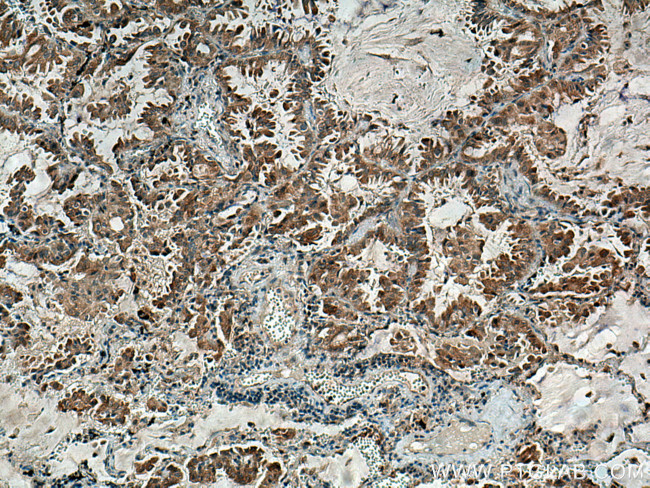 RNF145 Antibody in Immunohistochemistry (Paraffin) (IHC (P))