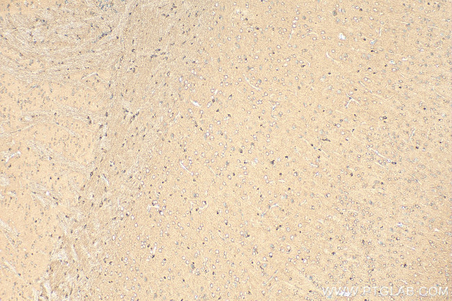 SYTL5 Antibody in Immunohistochemistry (Paraffin) (IHC (P))