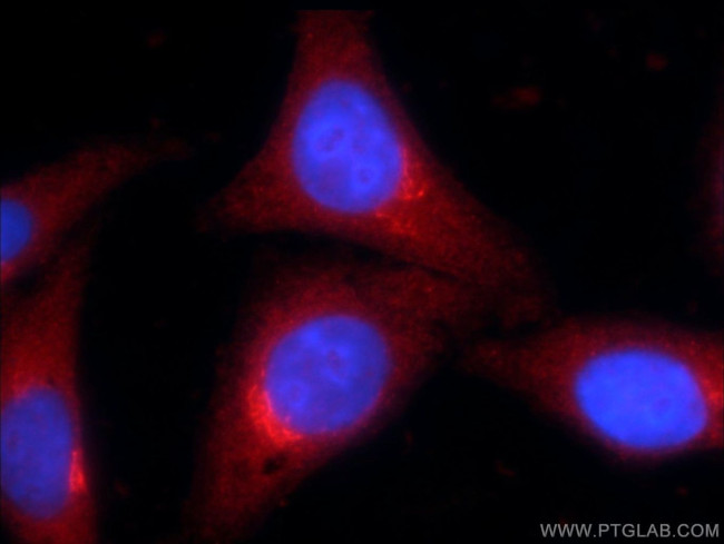 ZNF140 Antibody in Immunocytochemistry (ICC/IF)
