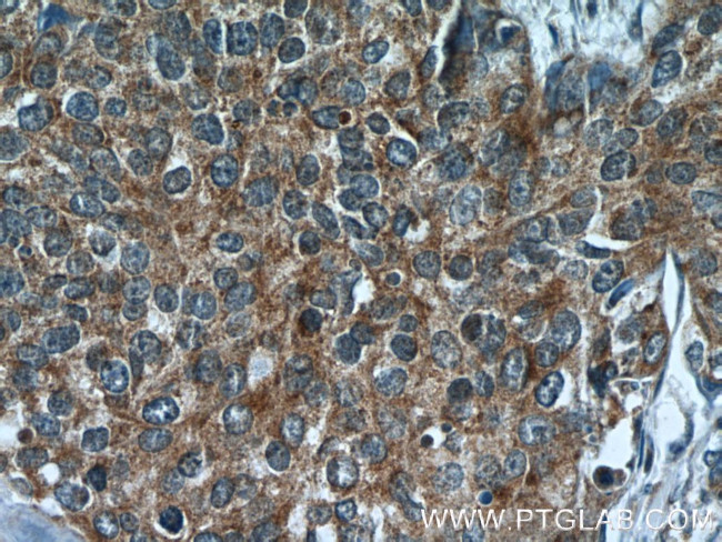 RNF25 Antibody in Immunohistochemistry (Paraffin) (IHC (P))