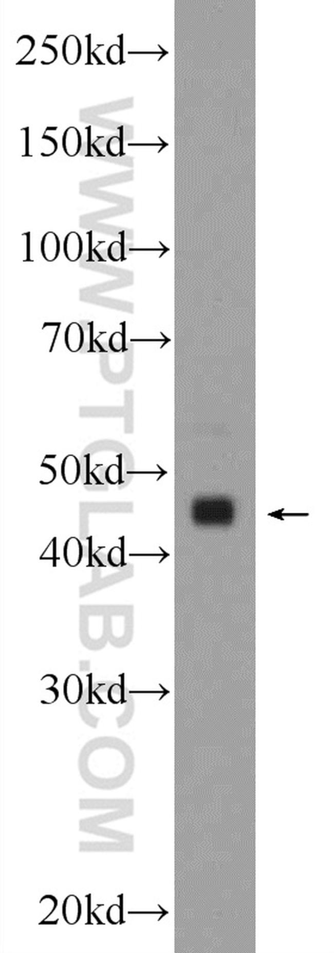 TMEM120B Antibody in Western Blot (WB)