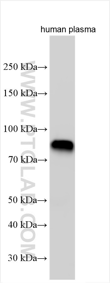 IGFALS Antibody in Western Blot (WB)