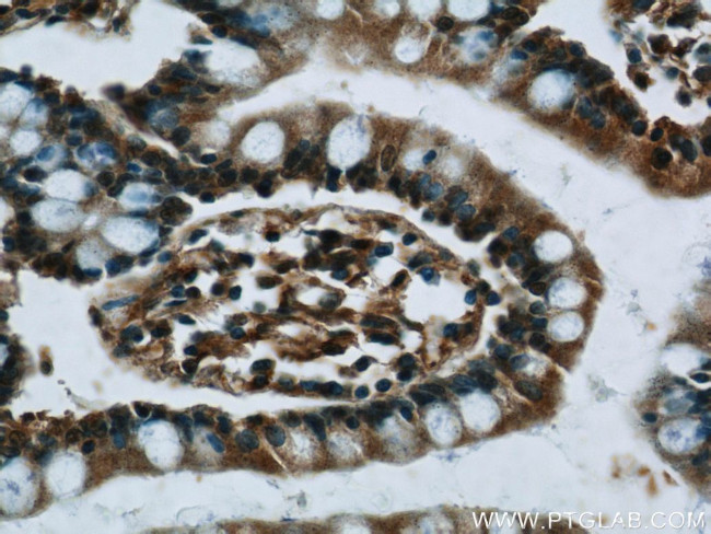 C8orf77 Antibody in Immunohistochemistry (Paraffin) (IHC (P))