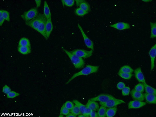 ENTPD7 Antibody in Immunocytochemistry (ICC/IF)