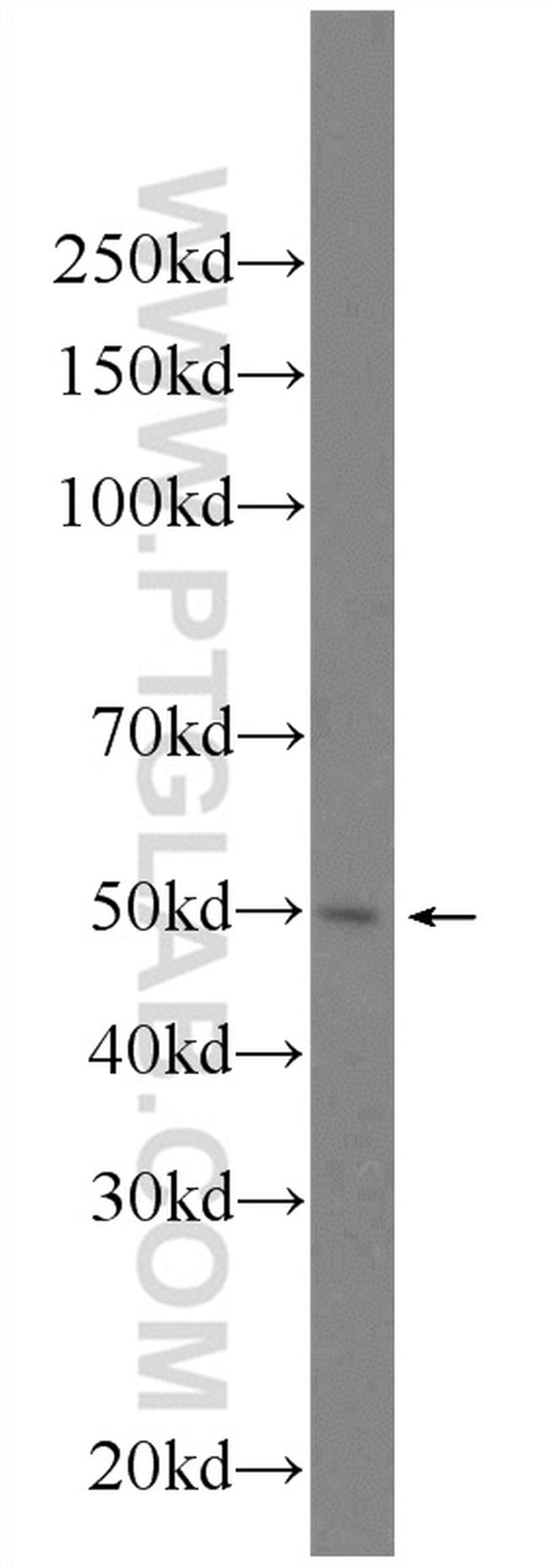FYTTD1 Antibody in Western Blot (WB)